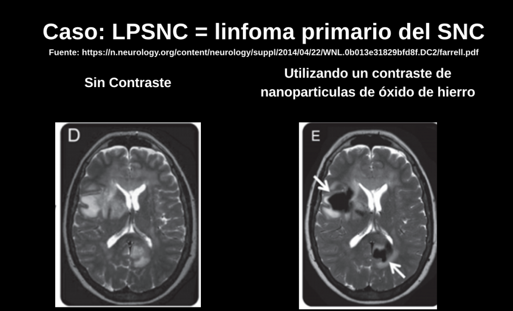 Nanomedicina. Nanotecnología en medicina. Física médica.