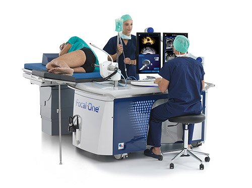 ultrasonido de alta intensidad HIFU para el tratamiento de cancer de prostata aplicaciones de la fisica medica