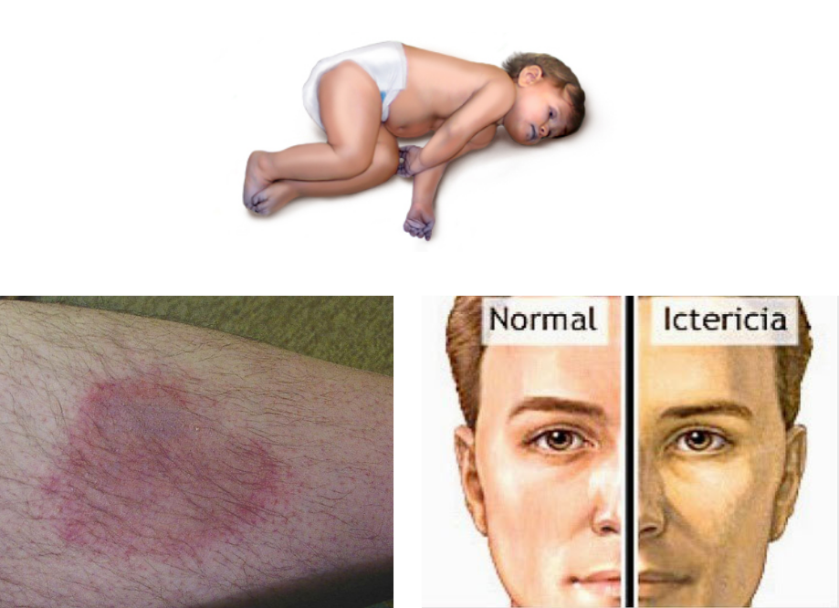 Cianosis.-Eritema.-Ictericia.