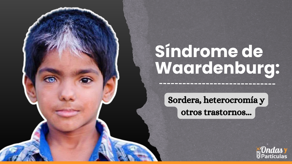 Síndrome de Waardenburg