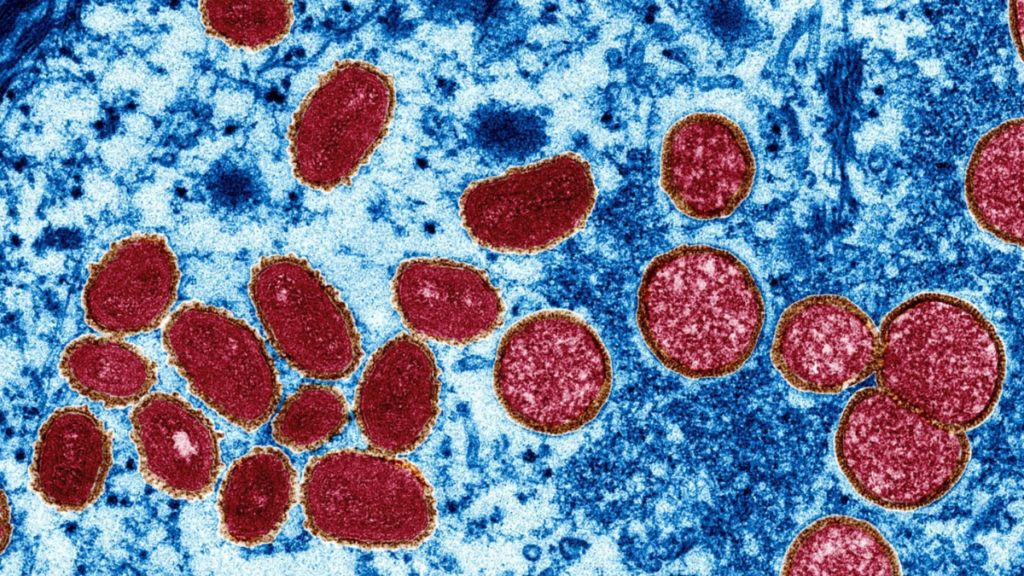 Viruela del mono Viruela del simio Esta imagen de microscopio electrónico muestra partículas del virus de la viruela del simio recolectadas de una muestra de piel humana del brote de 2003.