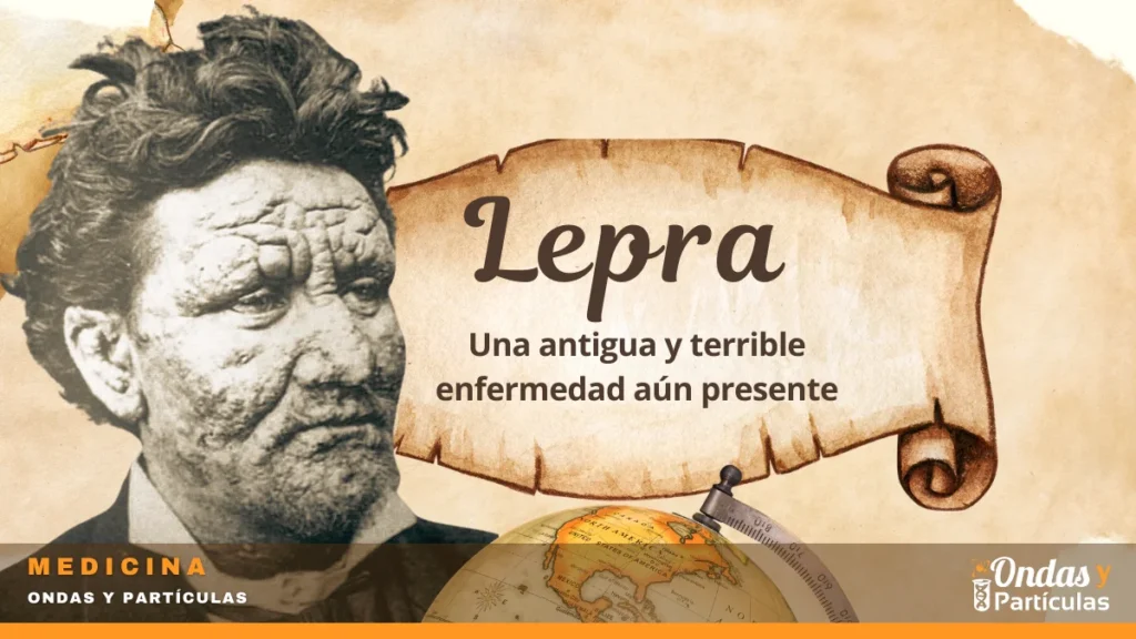 Lepra: una antigua y terrible enfermedad