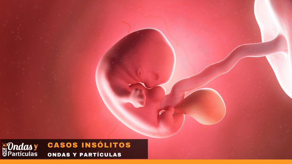 Una niña china de un año fue diagnosticada con un raro trastorno llamado fetus in fetu: su gemelo parásito crecía dentro de su cerebro. Niña con gemelo en el craneo